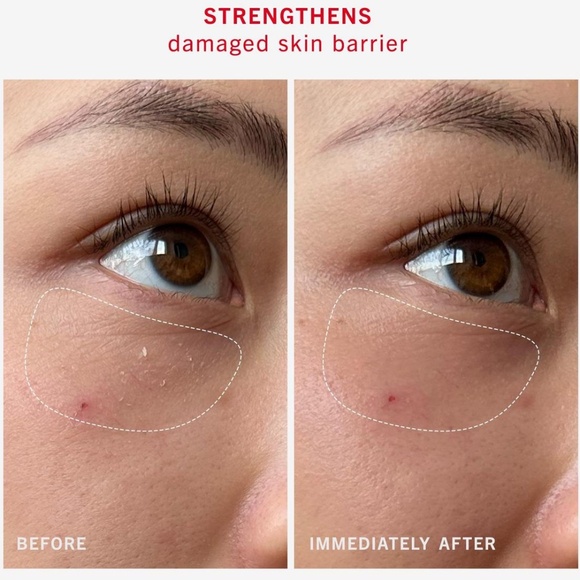 FIRST AID BEAUTY · ULTRA REPAIR RESCUE BARRIER BALM WITH 1% DIMETHICONE - Picture 5 of 8